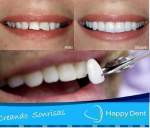 Fotos de Clinica Happy Dent