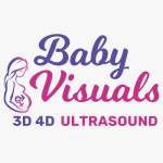 Photos of 3D/4D Baby Visuals Ultrasound Kitchener, Waterloo, Cambridge