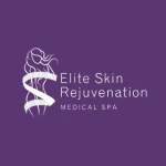 Photos of Elite Skin Rejuvenation