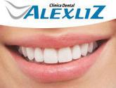 Clinica Dental Ortodoncia En Viña Del Mar Alexliz