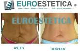 Fotos de Euroestetica Chile Ltda