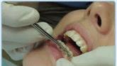 Fotos de Clinica Odontologia Especializada - Ortoestetica Ibague