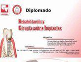 Fotos de Diplomados De Cirugía Sobre Implantes Y Rehabilitacion
