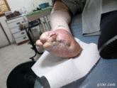 Fotos de Dr. Armando Calderon Ribero, Especialista Flebologo