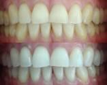 Fotos de Dr. Carlos Arturo Escandón- Implantes Y Odontología Integral