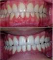Fotos de Dra. Monica Garcia Gutierrez, Rehabilitacion Oral
