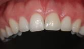 Fotos de Instituto Clínico De Periodoncia E Implantes Orales