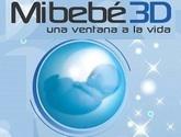 Fotos de Mi Bebe 3D