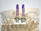 Fotos de Tecnologia Digital En Odontologia