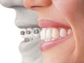 Fotos de Ortodoncia Cartago - Clinica Dental