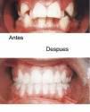 Fotos de “Dental Stetic”