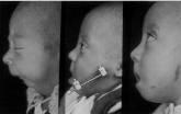 Fotos de Centro Quirúrgico Y Maxilofacial