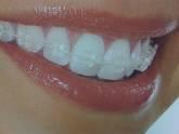 Fotos de Clinica Hbc-Orthodontic Dr. Hector Boada Coloma