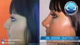 Fotos de Dr. Edgar Quintero Moyano Cirujano Plastico Y Reconstructivo