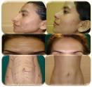 Fotos de Dra. Rita Ozaetta (Cirujana Plástica)