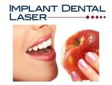 Fotos de Odontologia Sin Dolor Implant Dental Laser