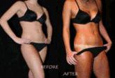 Fotos de Swiss Solarium
