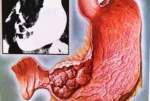 Fotos de Dr. Rodman E. García V. Gastroenterólogo