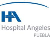 Fotos de Alta Especialidad En Prótesis De Cadera Y Rodilla En Puebla