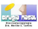 Fotos de Cirugía Estética De Nariz, Otorrinolaringología