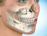 Fotos de Cirugia Oral Maxilofacial Dr. Manuel Lopez Hernandez
