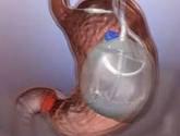 Fotos de Endoscopias Y Equipo Medico