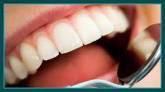 Fotos de Especialidades Dentales. Rehabilitación Funcional Y Estética