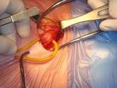 Fotos de Gastrocirugia Y Cirugia Laparoscopica Dr Rafael Garcia O.