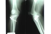Fotos de Ortopedia Y Traumatología