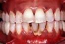 Fotos de Periodoncia E Implantes Dentales En Tampico Dra. Nilse Eraña