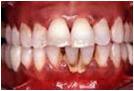 Fotos de Periodoncia E Implantes Dentales Saltillo Dra. Nilse Eraña