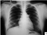 Radiologia Del Norte S.c. Aguascalientes