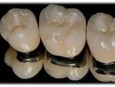 Fotos de Laboratorio Dental Titanium