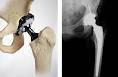 Fotos de Orthoimplantes, C.a