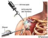 Traumatologo -Dr Jesus Rojas