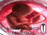 Fotos de Unidad De Gineco-Obstetricia.
